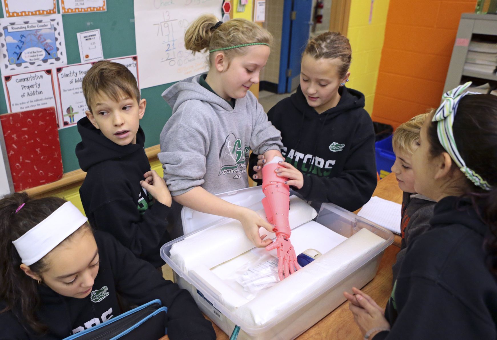 Kids test lower cost and lighter weight prostheses made by 3D printers in new study at Children's Hospital